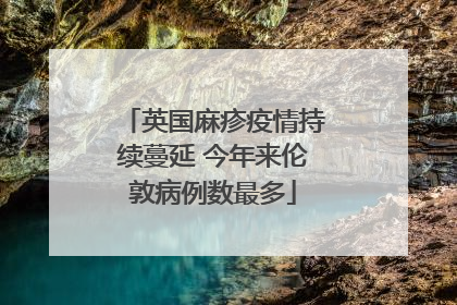 英国麻疹疫情持续蔓延 今年来伦敦病例数最多